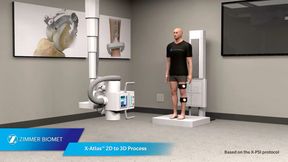 X-Atlas 2D to 3D process — manufacturer video image