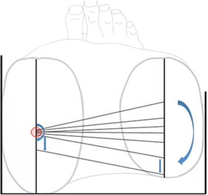 Published superior-view diagram showing connecting lines rotating around the medial side